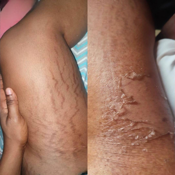 Avant / Après de Christelle K.