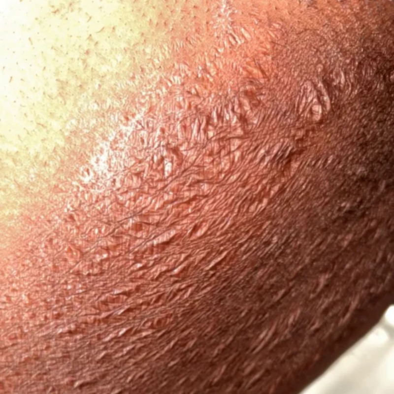 Jour 5 : Premiers effets