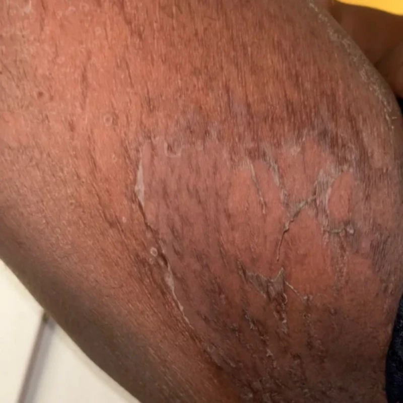 Jour 10 : Phase active