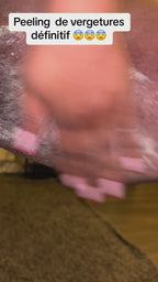 Black soap peeling anti-stretch marks