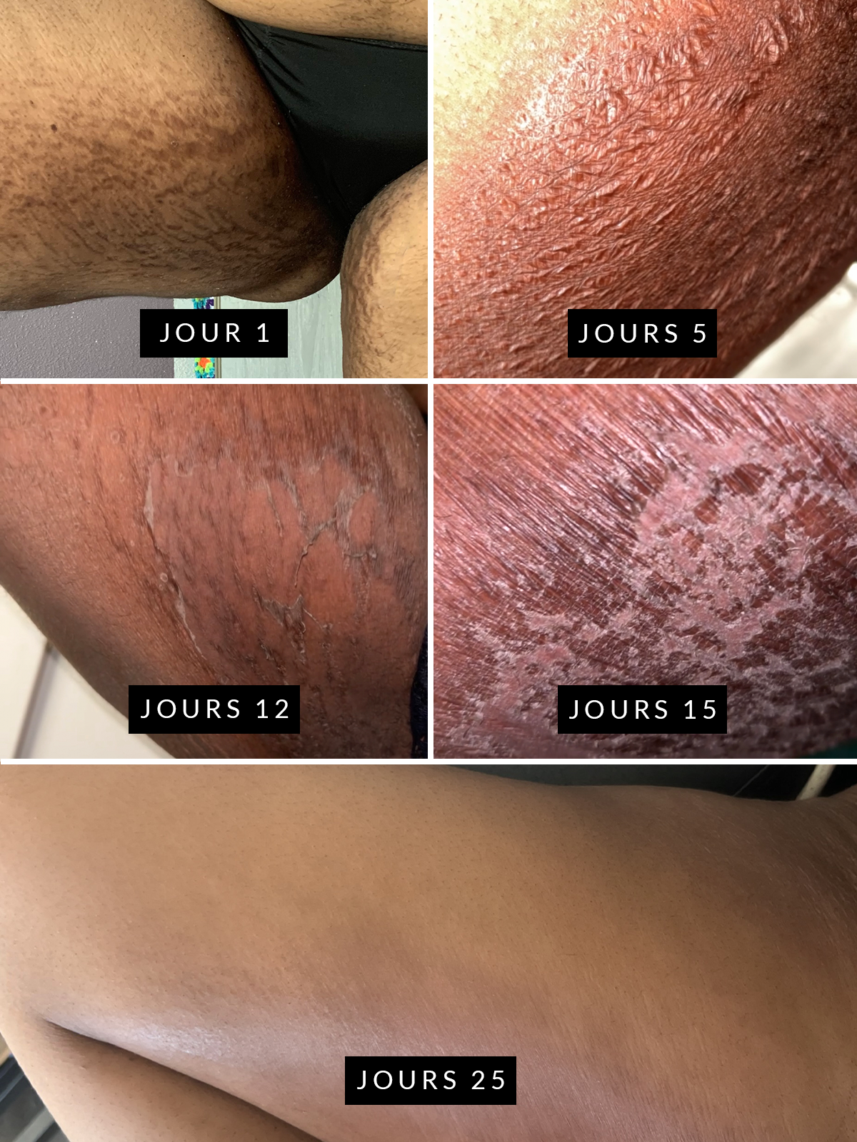 Rituel : Soin revitalisant vergeture